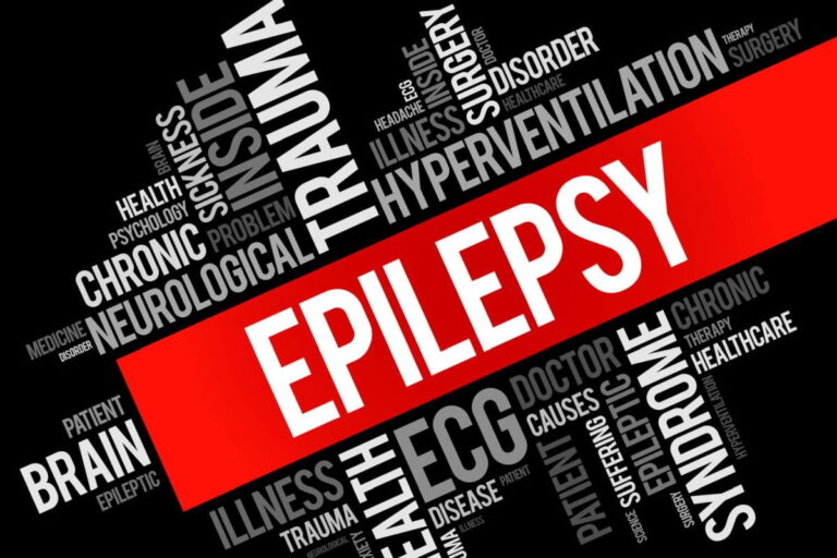 Epilepsy Surgery