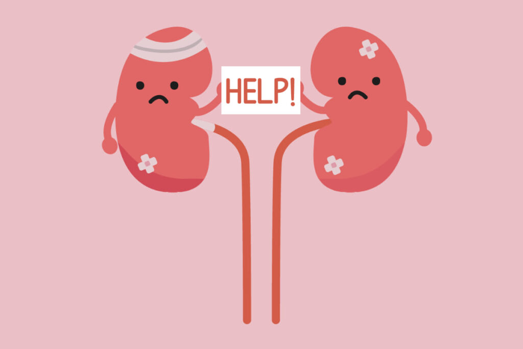 Kidney Stone Laser Treatment