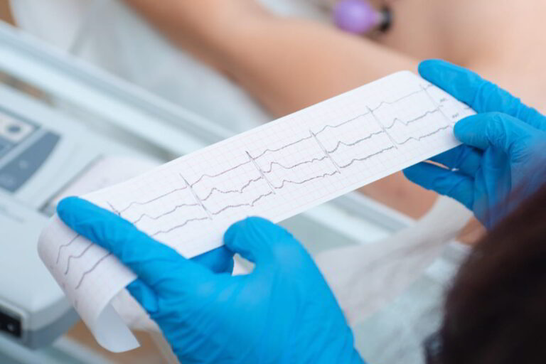 Tachycardia Treatment