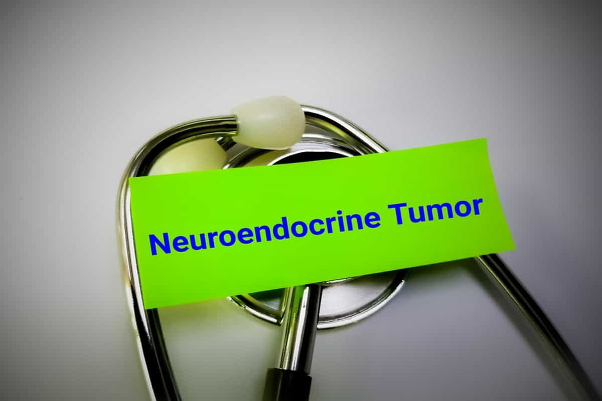 Neuroendocrine Tumor Symptoms, Treatments, Causes & More