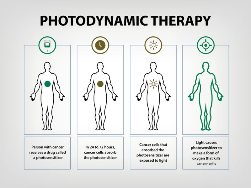 Photodynamic Therapy For Cancer