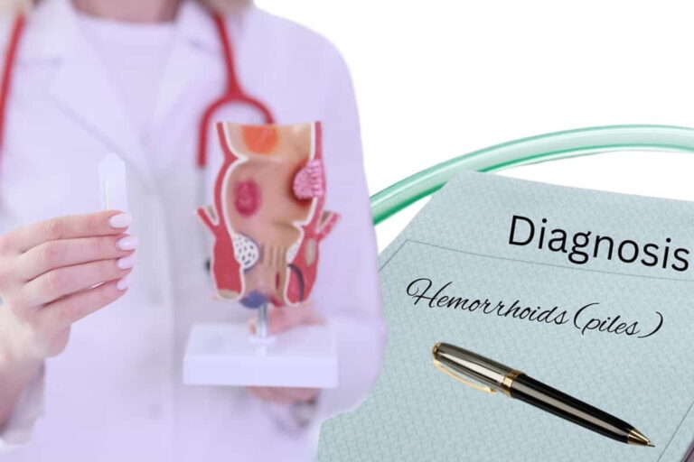 Piles Laser Treatment Cost