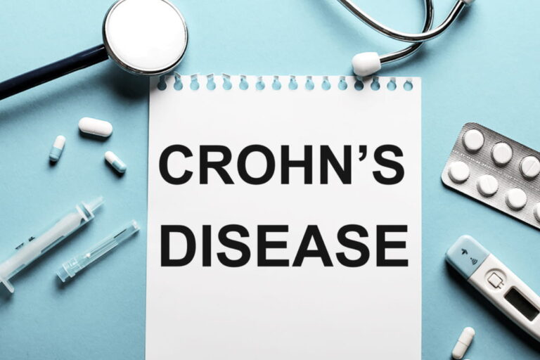 Crohn's Disease Treatment