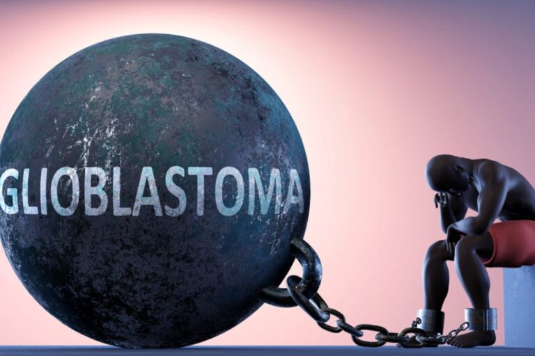 Glioblastoma