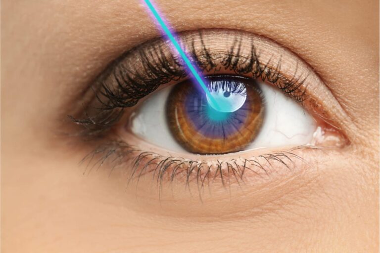 Lasik Surgery Cost In Delhi