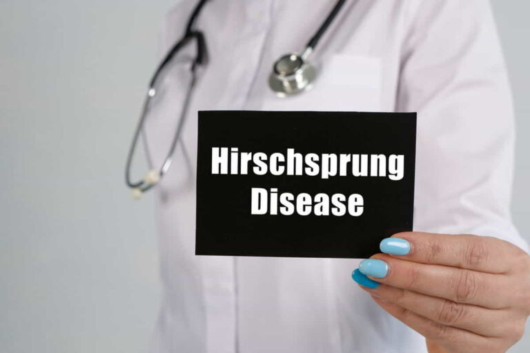 Hirschsprung Disease Treatment