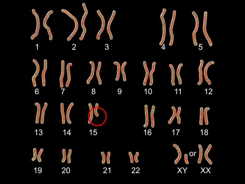 Prader-Willi Syndrome Genetics