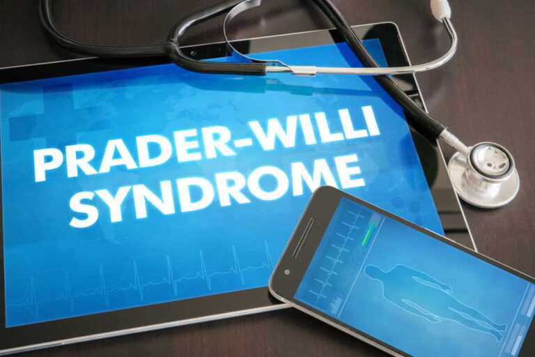 Prader-Willi Syndrome