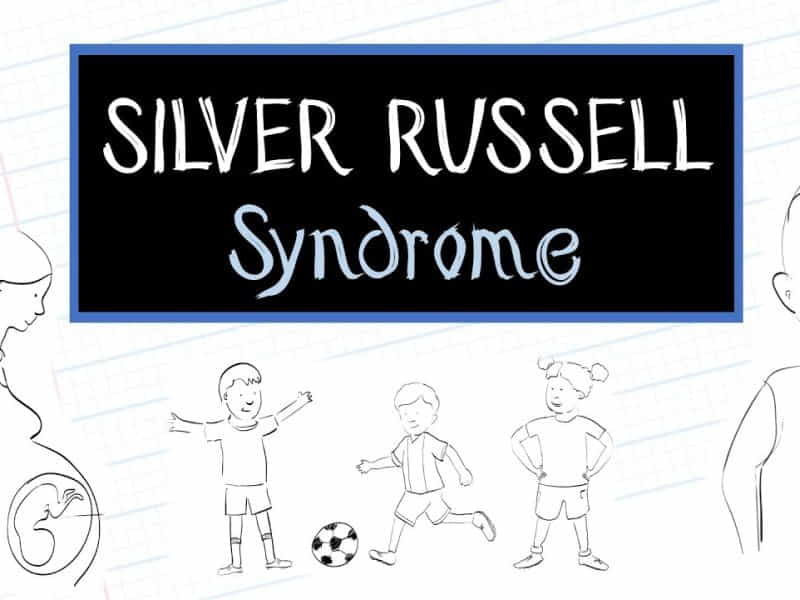 Silver Russell Syndrome