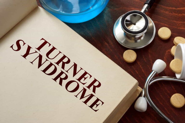 What Is Turner Syndrome