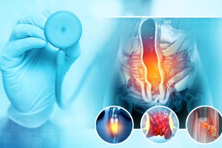 Piles Laser Treatment Cost In Hyderabad