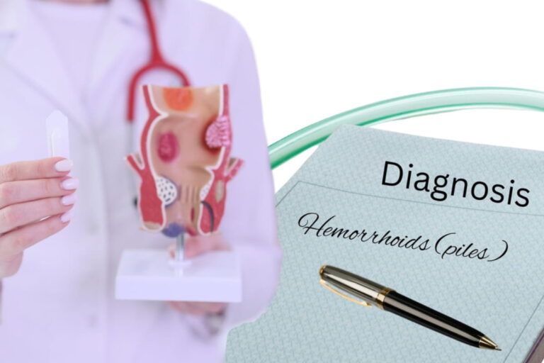 Piles Laser Treatment Cost In Patna