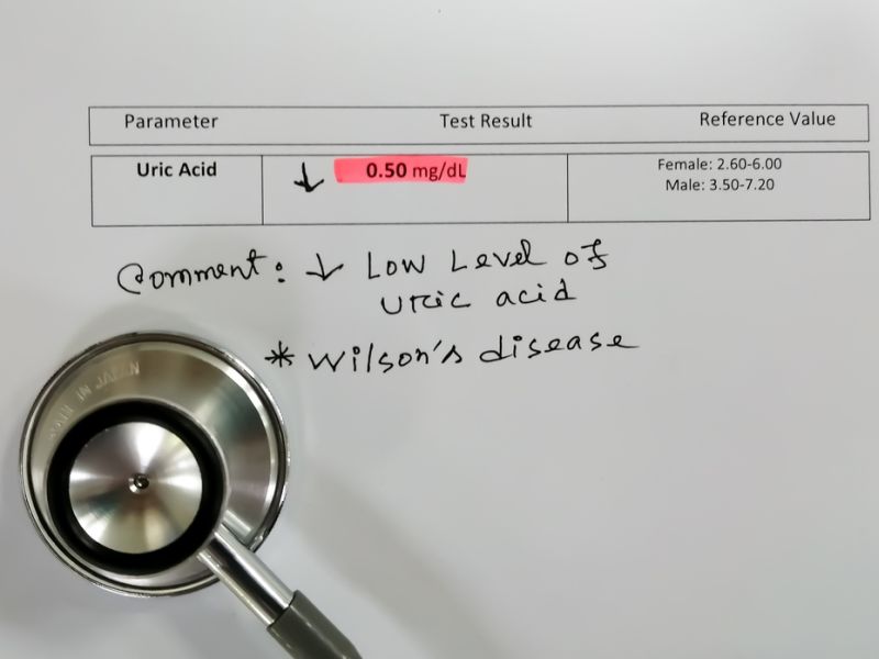 Wilson Disease Symptoms
