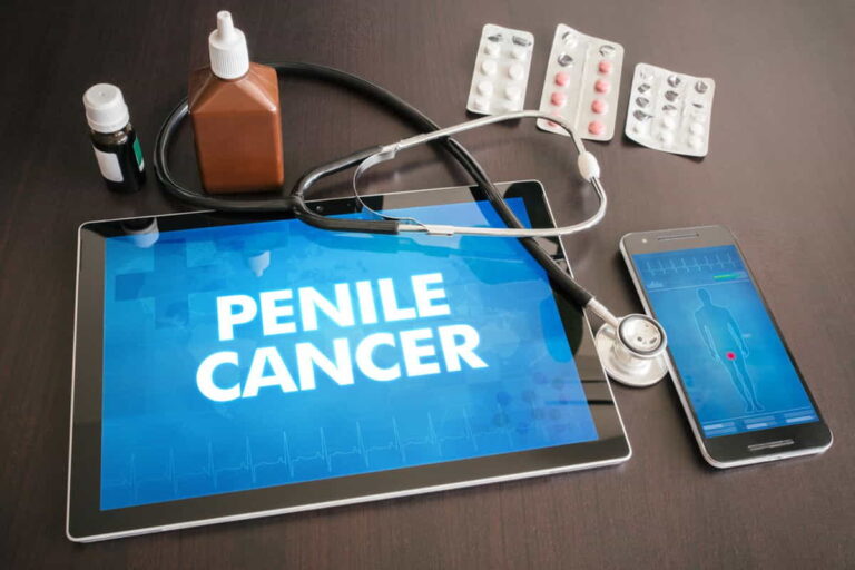 Penile Cancer Symptoms