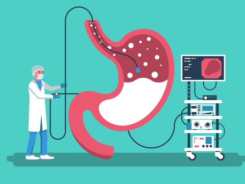 Cost Of Endoscopy In Bangalore