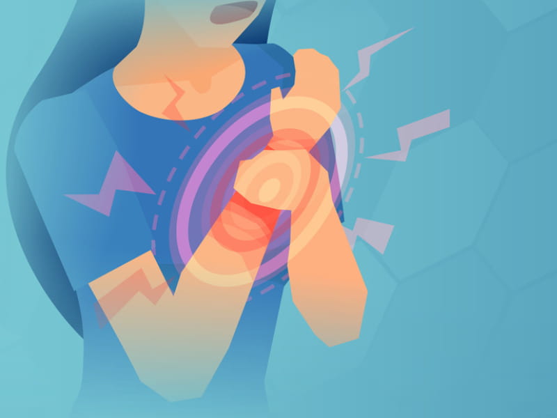 Carpal Tunnel Syndrome Treatment