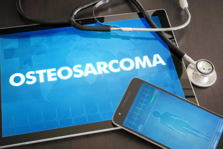Osteosarcoma Meaning
