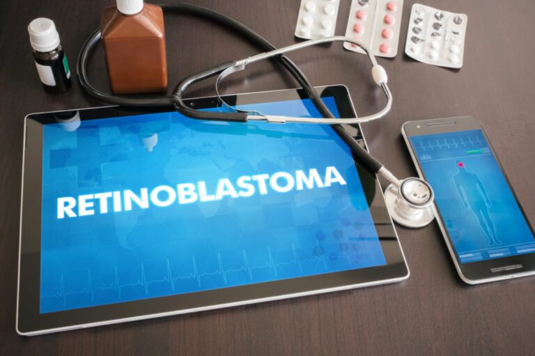 Retinoblastoma