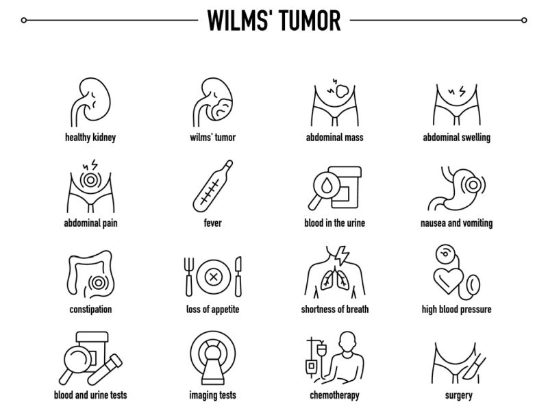 Wilms Tumor Treatment