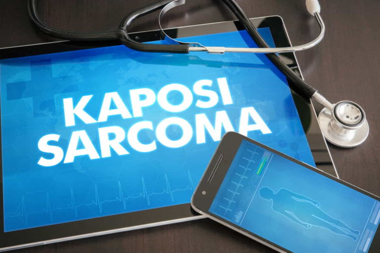 Kaposi Sarcoma Meaning