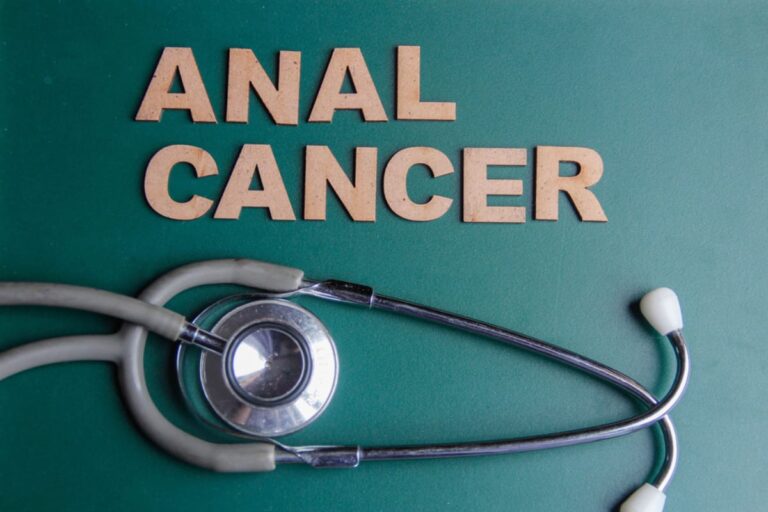 Anal Cancer