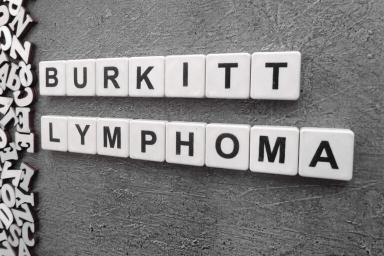 Burkitt Lymphoma