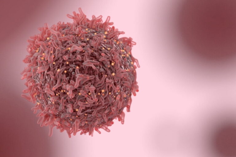 Thymoma And Thymic Carcinoma