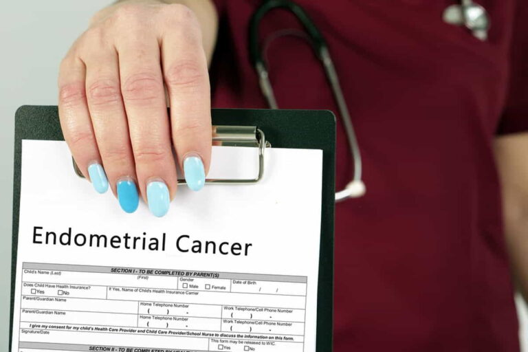 Endometrial Cancer Symptoms