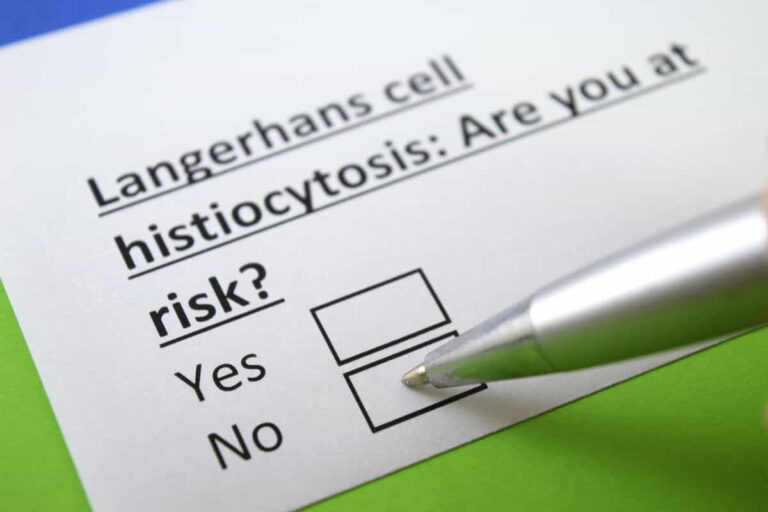 Langerhans Cell Histiocytosis Radiology