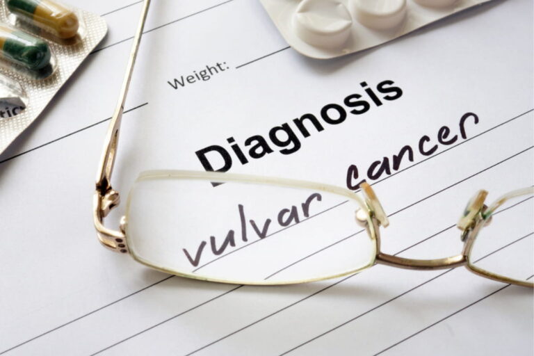 Vulvar Cancer