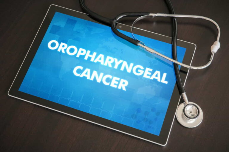 Oropharyngeal Cancer Causes