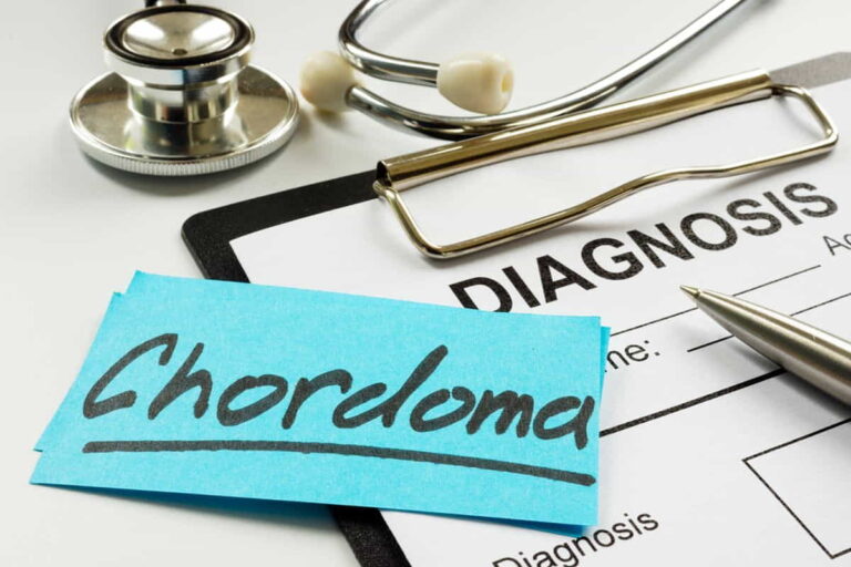 Chordoma Meaning