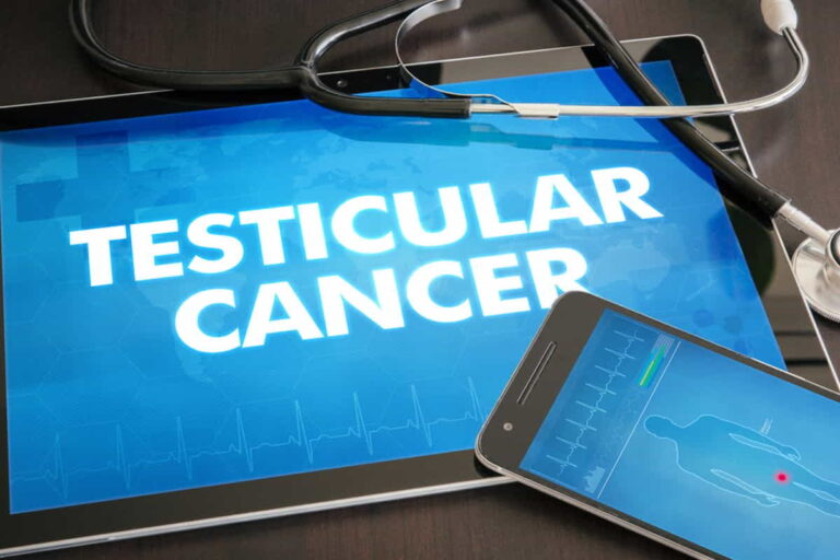 Testicular Cancer