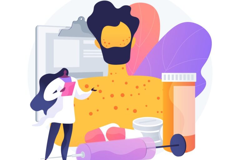 Merkel Cell Carcinoma Prognosis