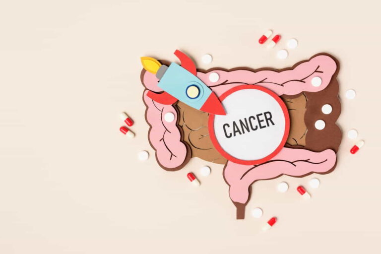 Adrenocortical Carcinoma Diagnosis