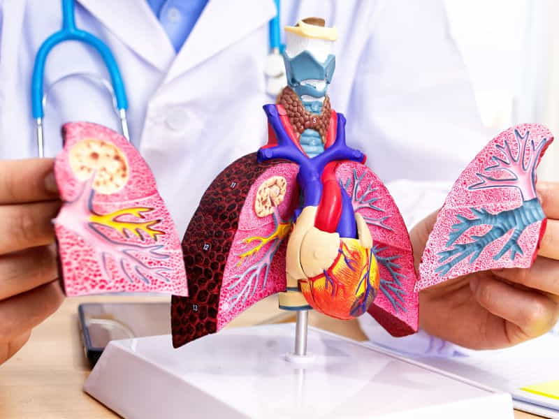 Pleuropulmonary Blastoma Symptoms