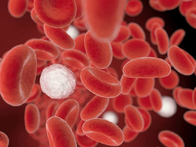 Acute Lymphoblastic Leukemia Symptoms