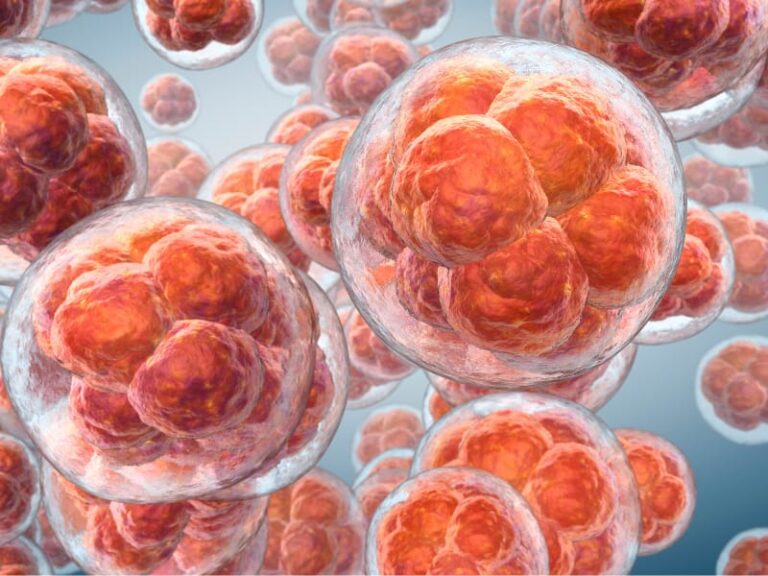 CAR-T Cell Therapy cost in India