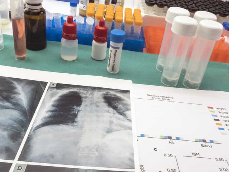 Pneumonia Symptoms