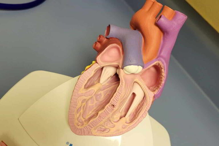 Atrial Septal Defect Symptoms
