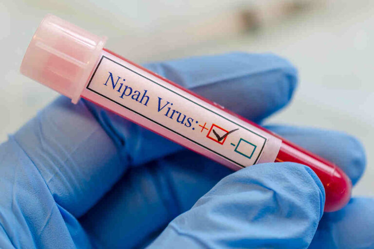 Nipah Virus Symptoms