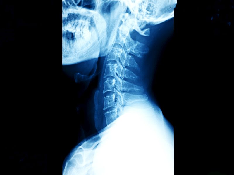 Cervical Pain In Hindi