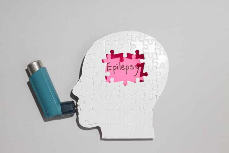 Epilepsy Meaning In Hindi