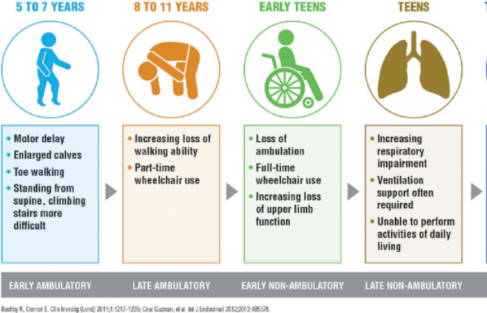 muscular dystrophy, Impact Guru
