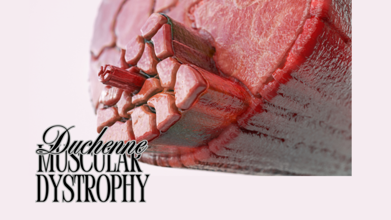 Duchenne Muscular Dystrophy Affects Muscles