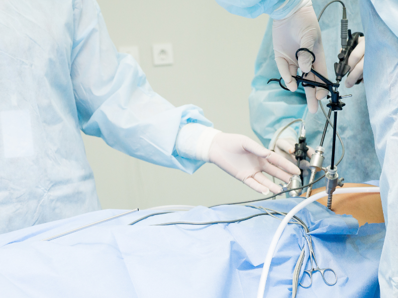 Laparoscopic Myomectomy Surgery Cost In India, Impact Guru