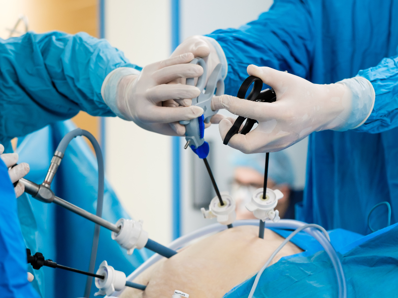 Laparoscopic Surgery Cost In India, Impact Guru