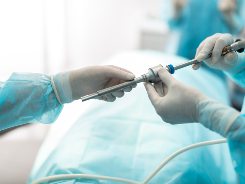 Laparoscopic Myomectomy Surgery Cost In India, Impact Guru