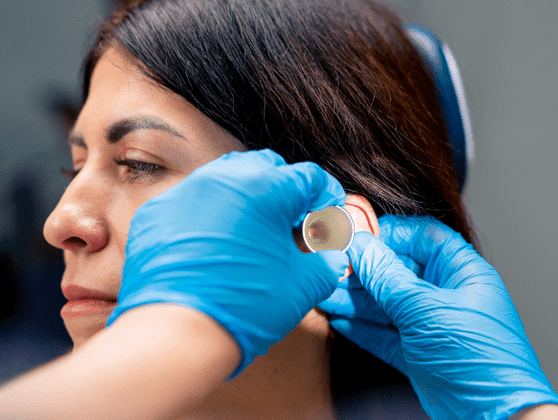 Otoplasty Cost In India, Impact Guru