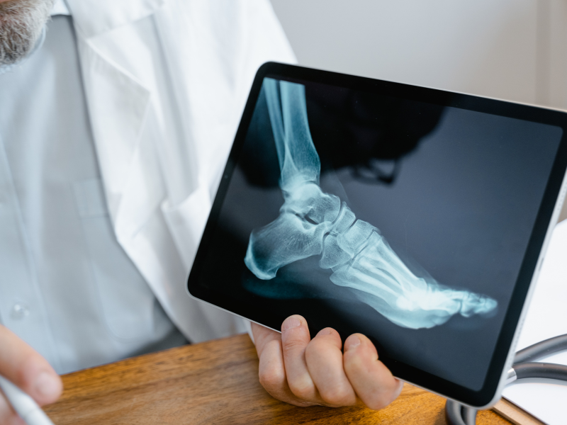 Bone Scan Cost In India, Impact Guru
